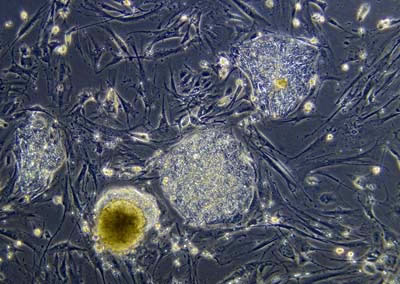 Foto microscópica de células mãe embrionárias.