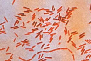 Bactérias causadoras da febre tifoide.